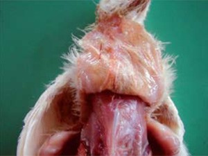 BỆNH VIÊM RUỘT HOẠI TỬ