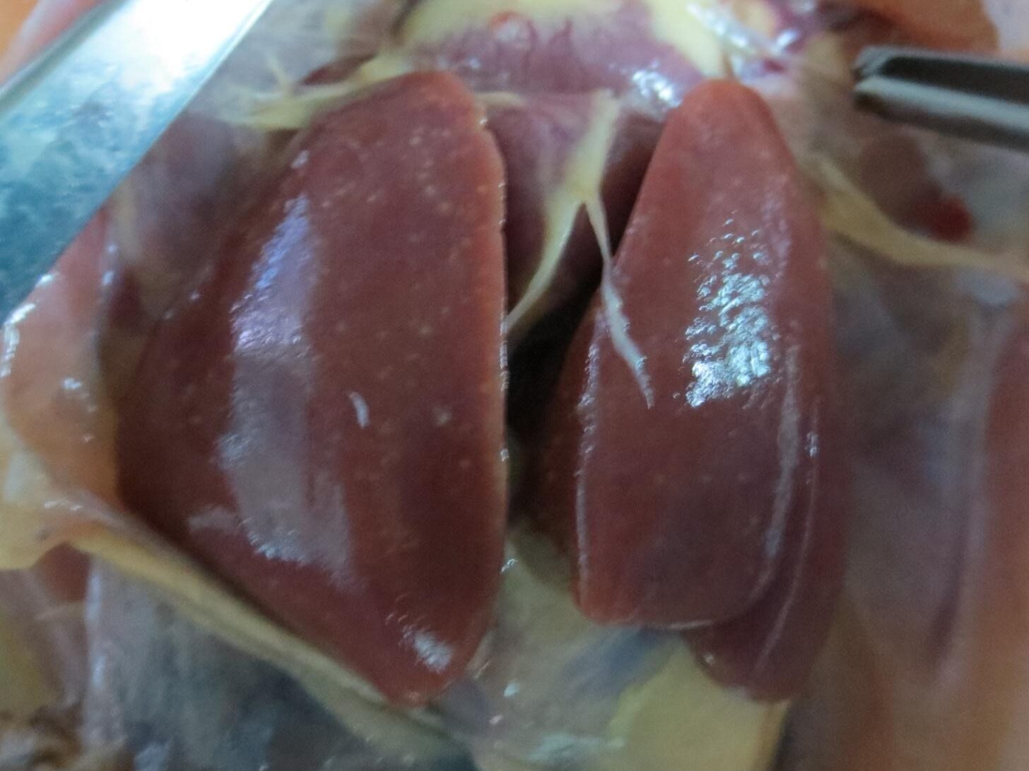 BỆNH TIÊU CHẢY DO SALMONELLA